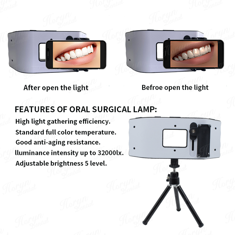 Dental Flash Light Photography - Photography Lighting With Flash 评论和价格